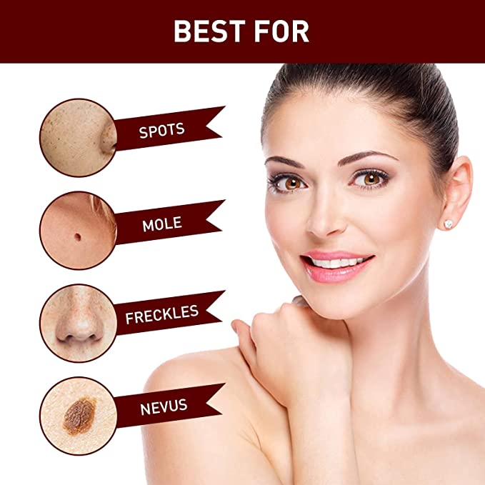 Tags & Moles Remover